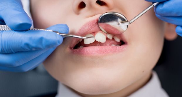 Detailed information about dental implants procedure